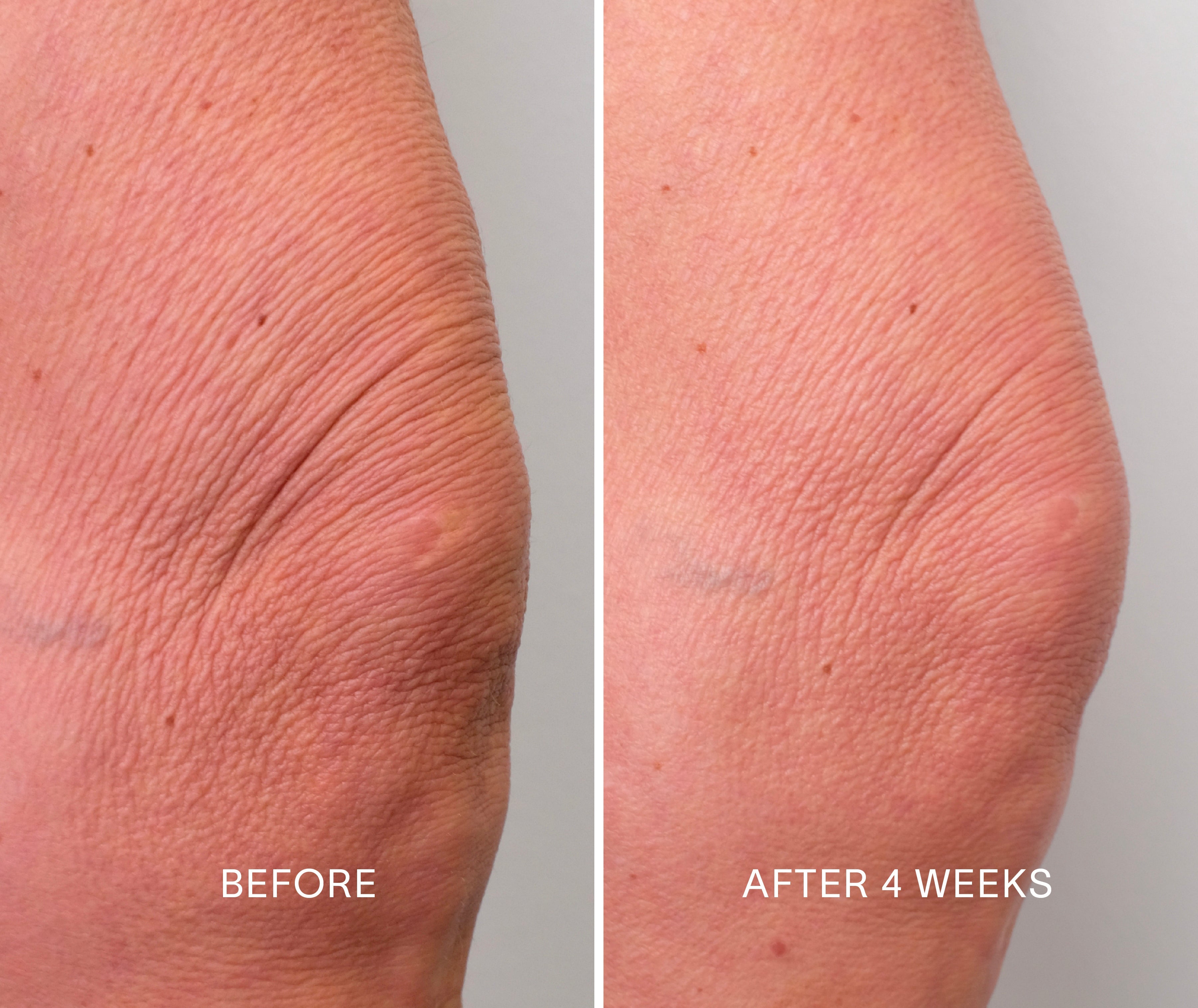 Body Repair Treatment – Firming Body Serum with Bakuchiol & Glycolic Acid