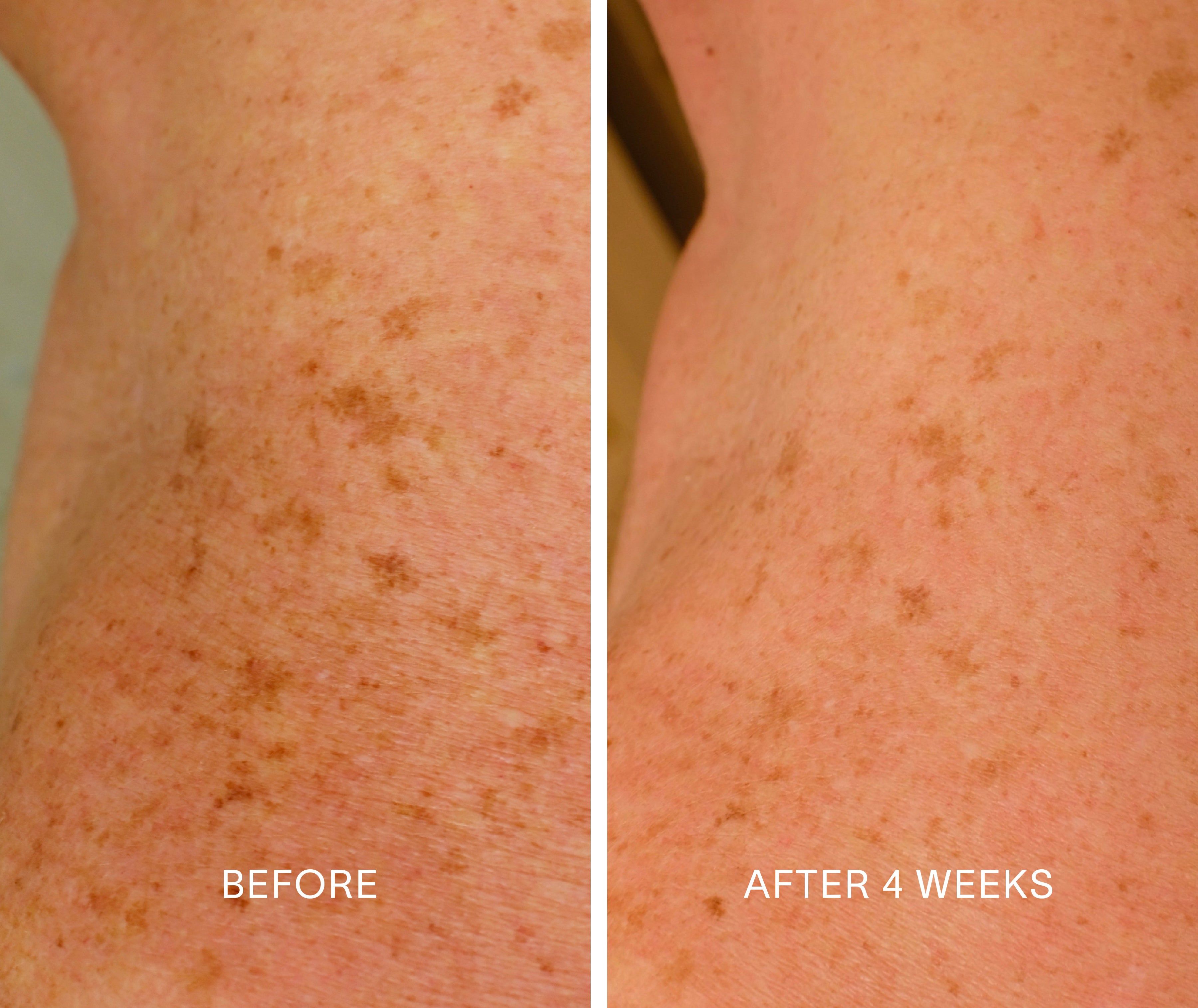 Body Repair Treatment – Firming Body Serum with Bakuchiol & Glycolic Acid