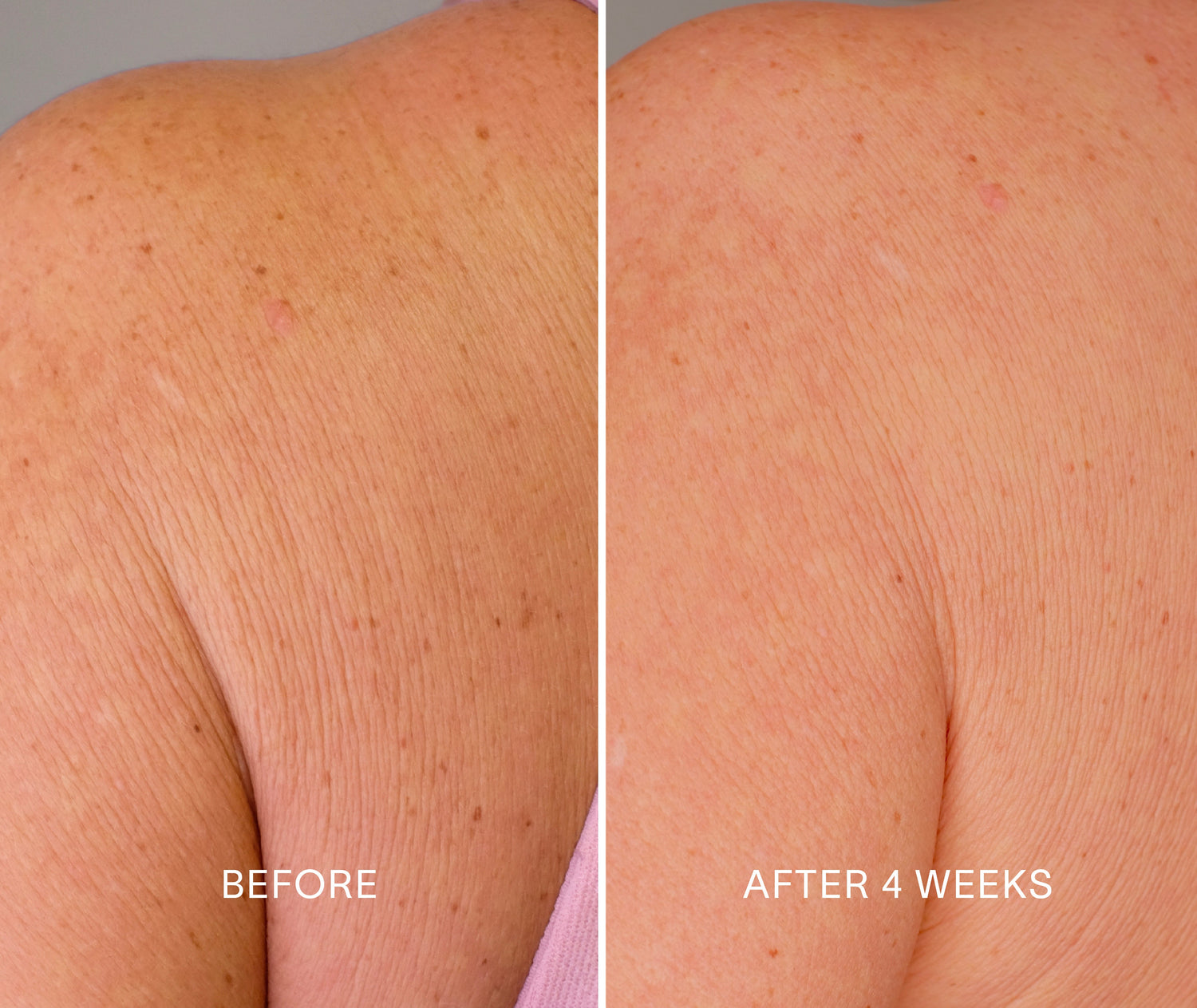 Body Repair Treatment – Firming Body Serum with Bakuchiol & Glycolic Acid