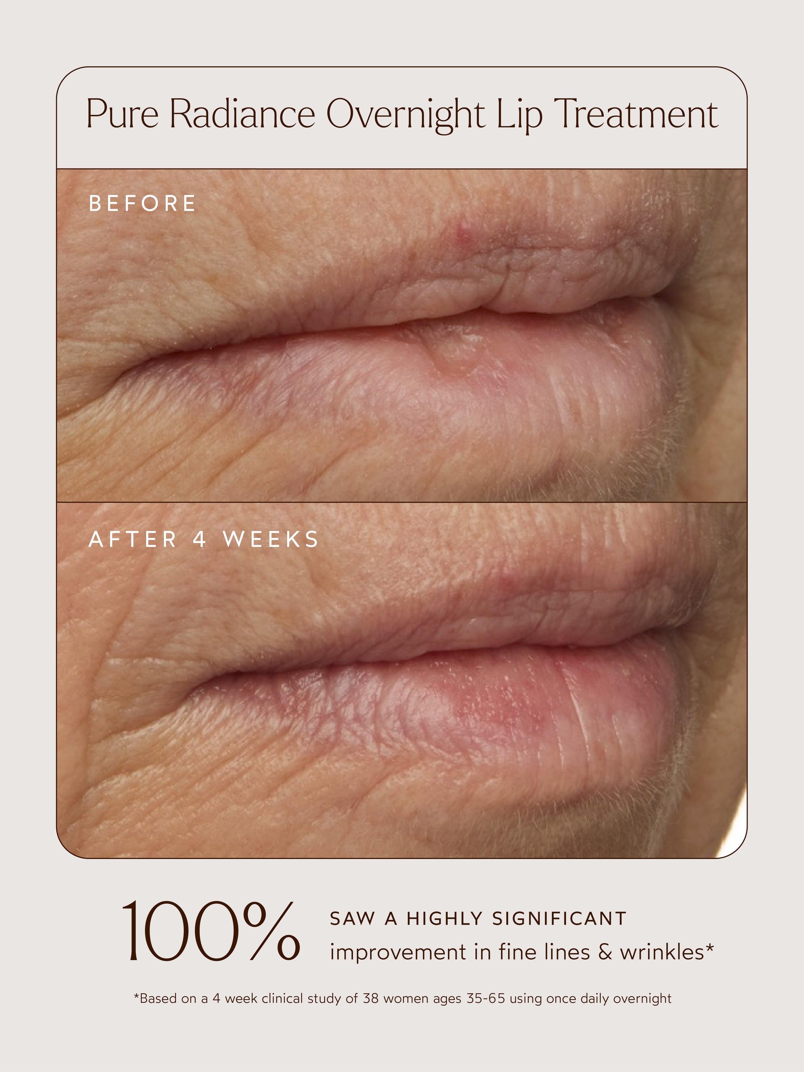 Pure Radiance Overnight Lip Treatment