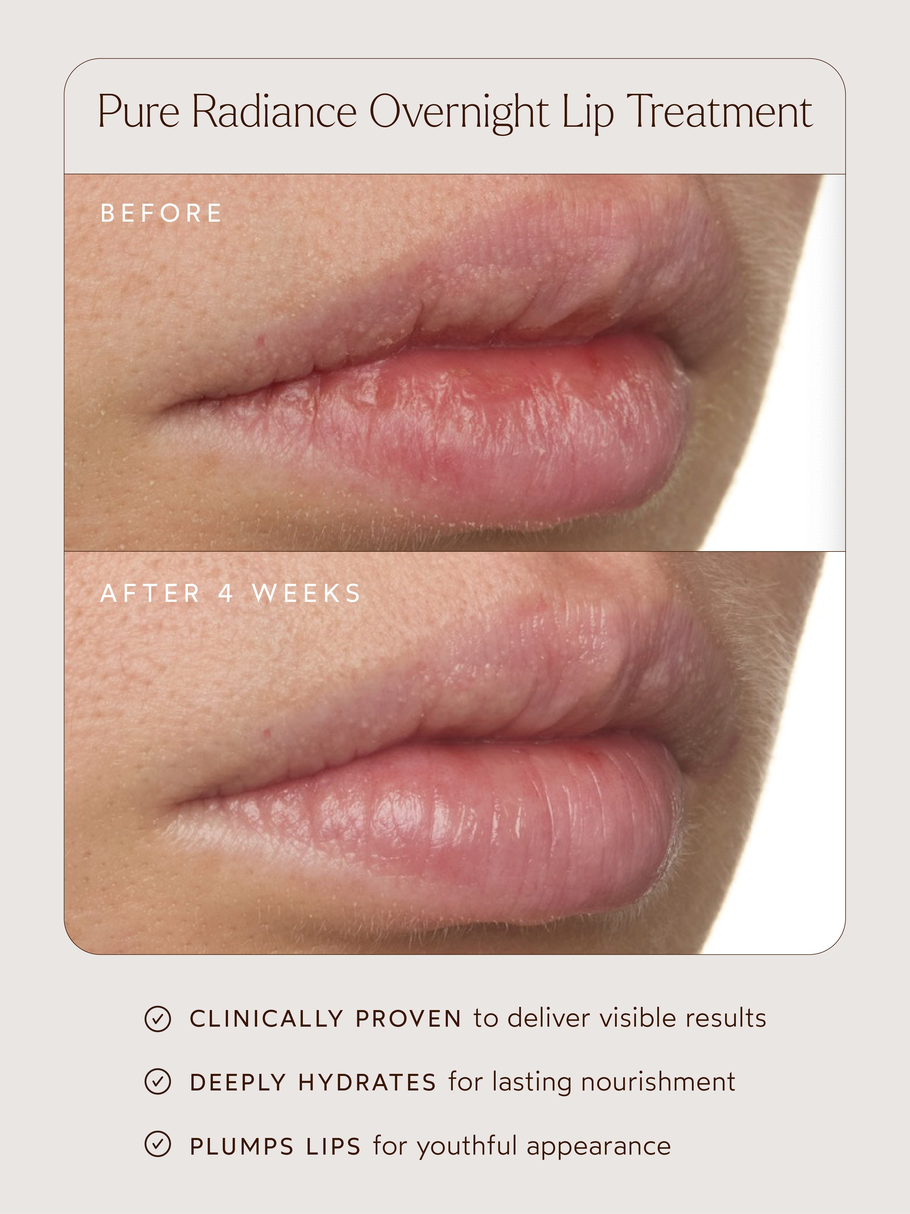 Pure Radiance Overnight Lip Treatment