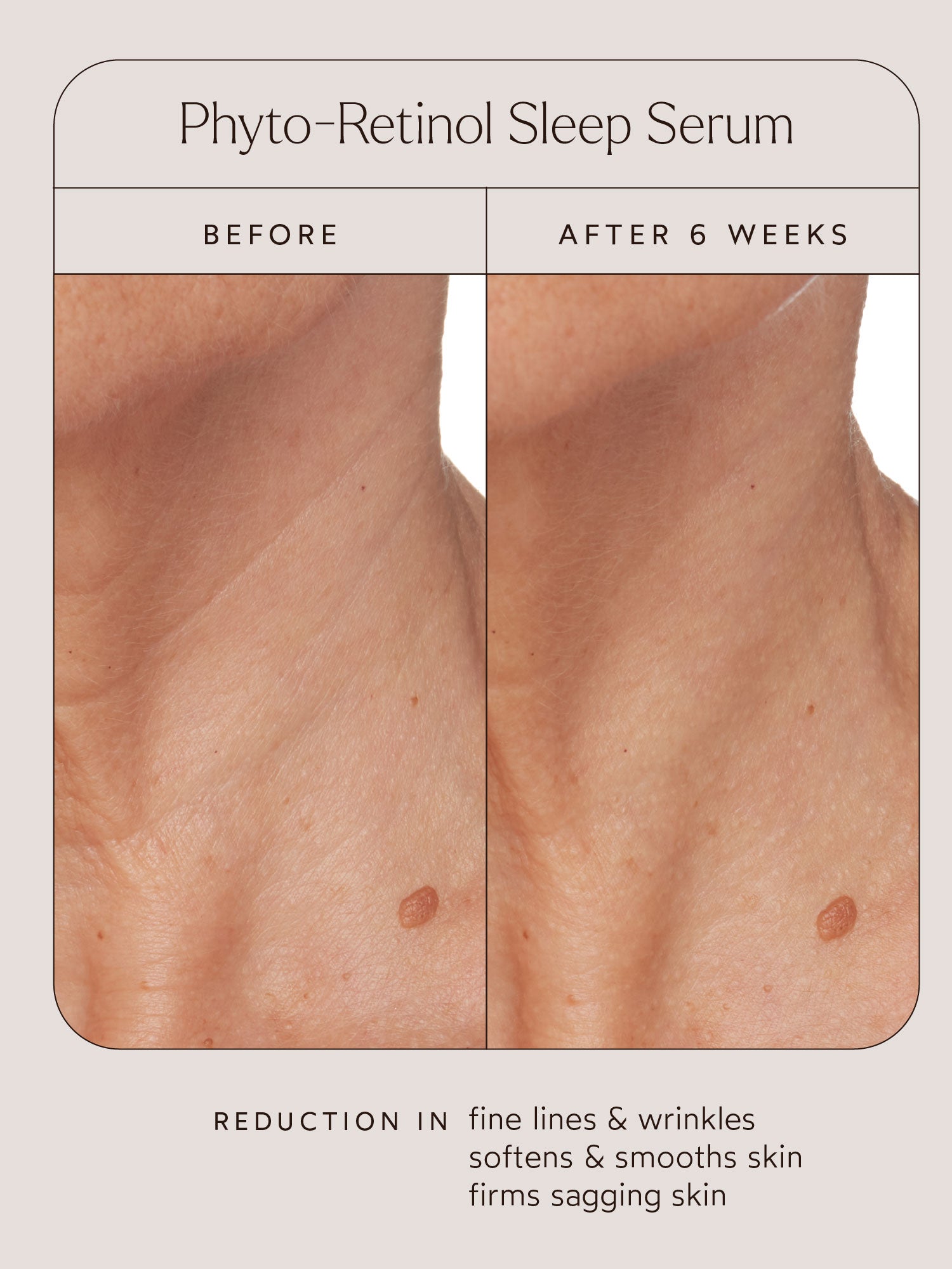 Phyto-Retinol Sleep Serum