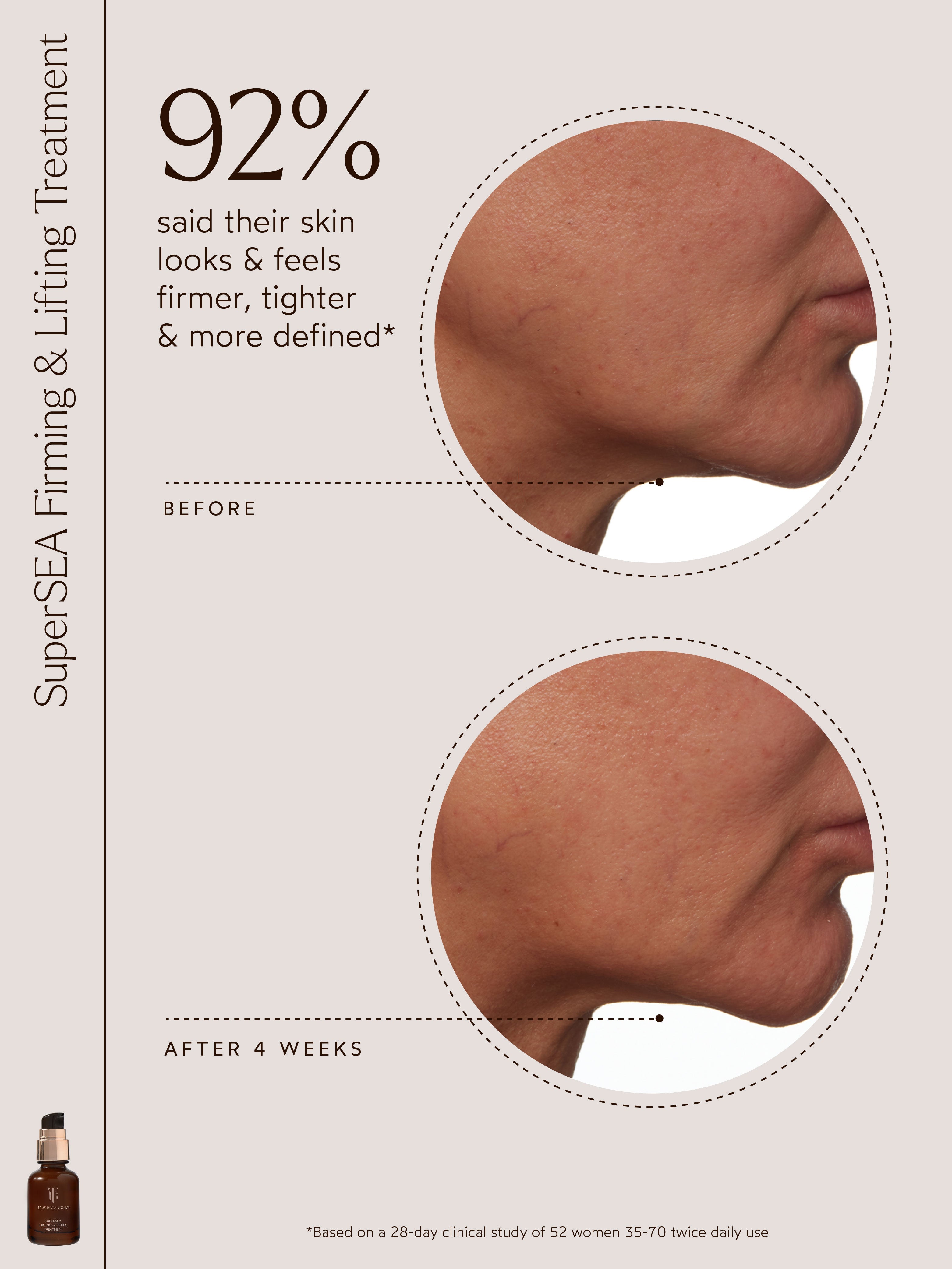 SuperSEA Firming & Lifting Treatment