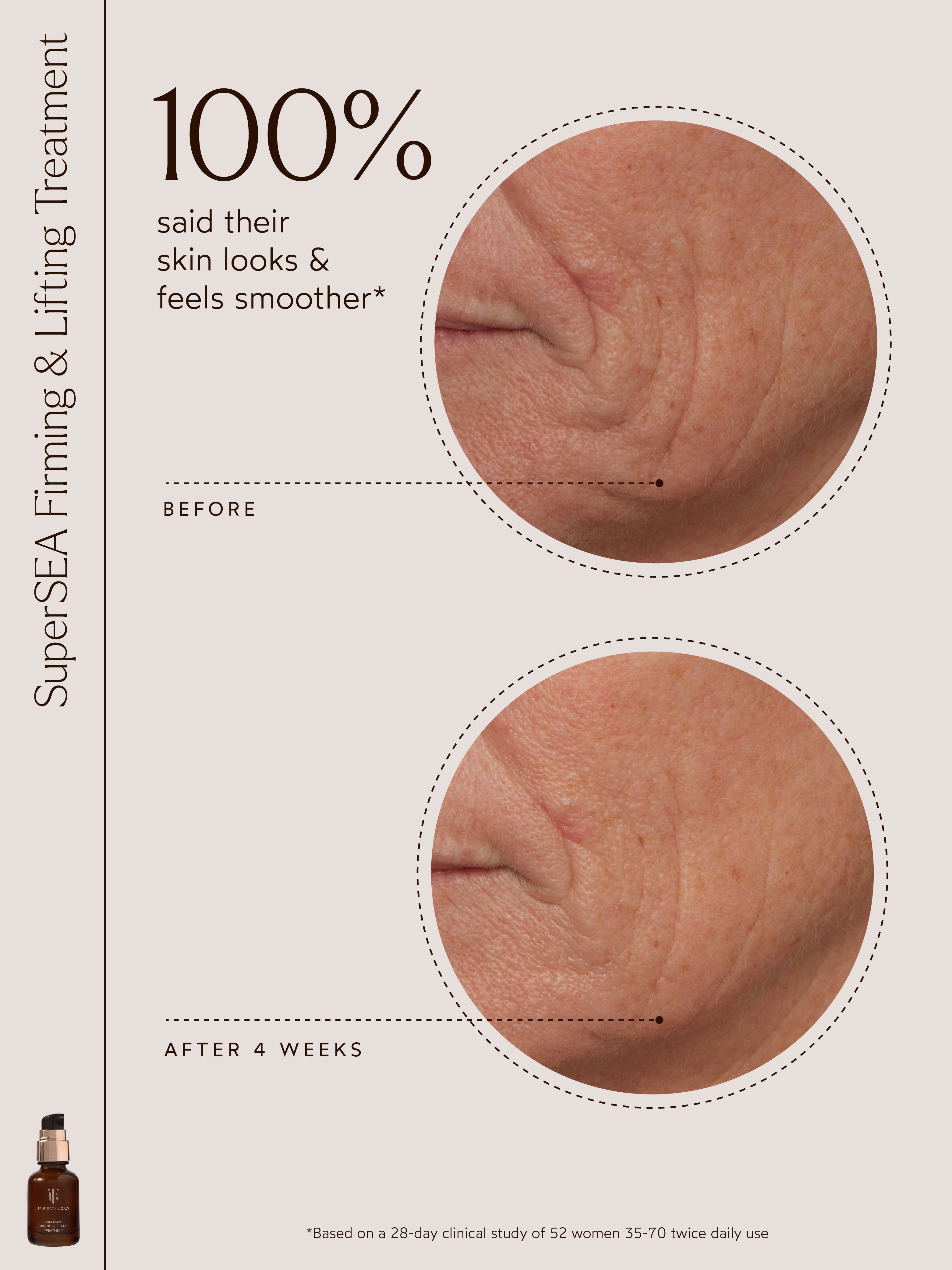 SuperSEA Firming & Lifting Treatment