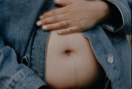 Stretch Marks: What Actually Helps