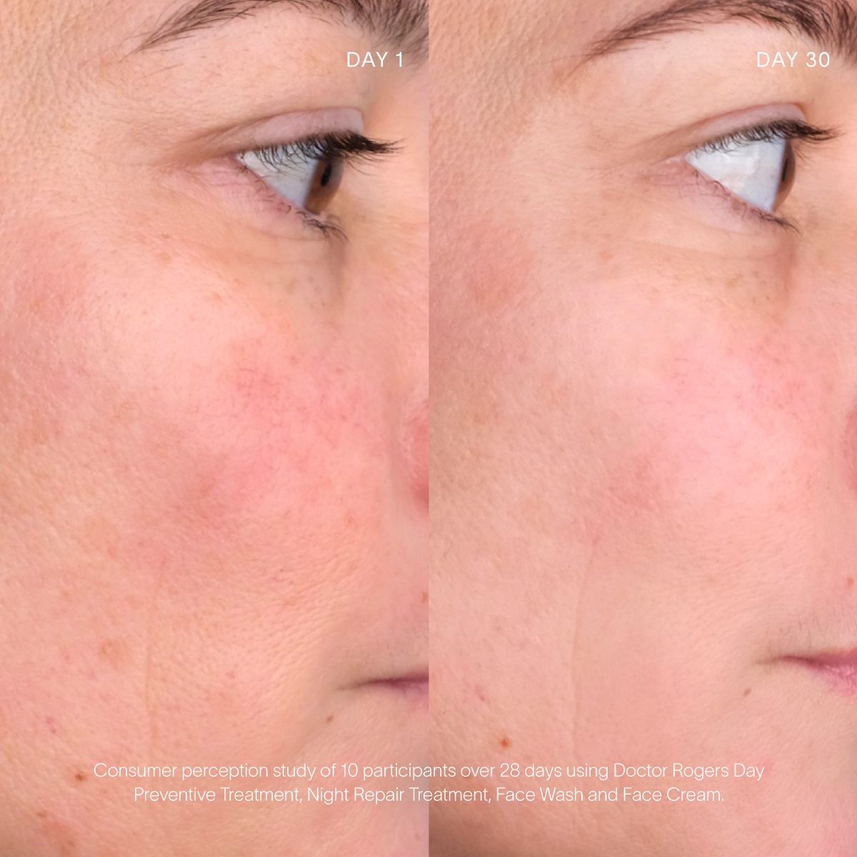 Advance Duo Refills