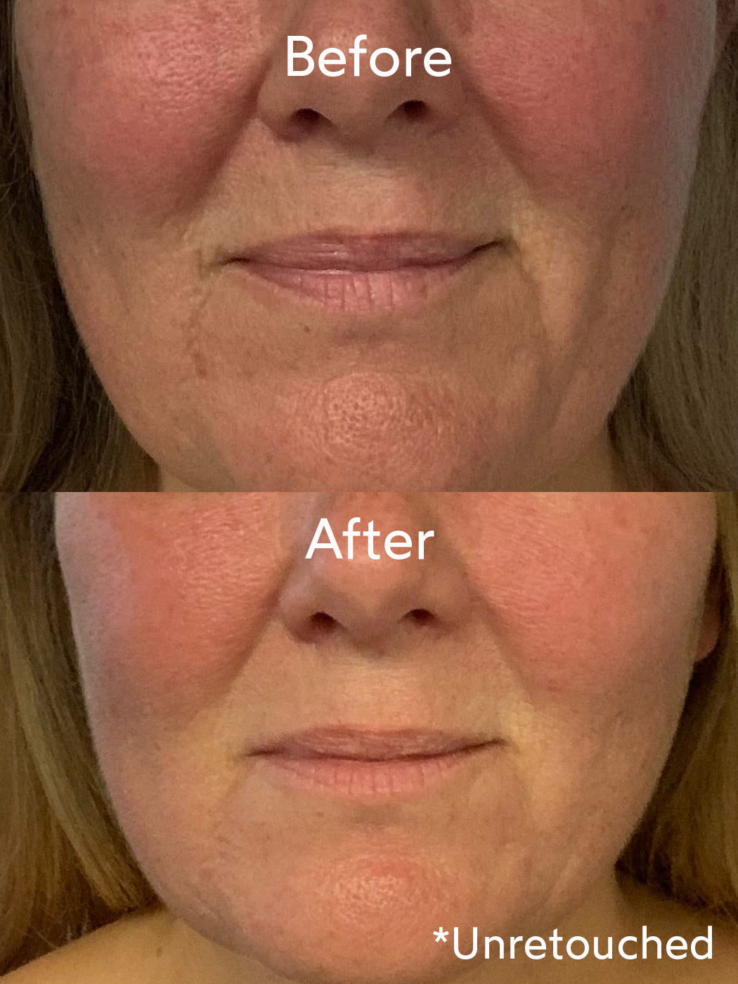 Renew Repair Nightly Treatment
