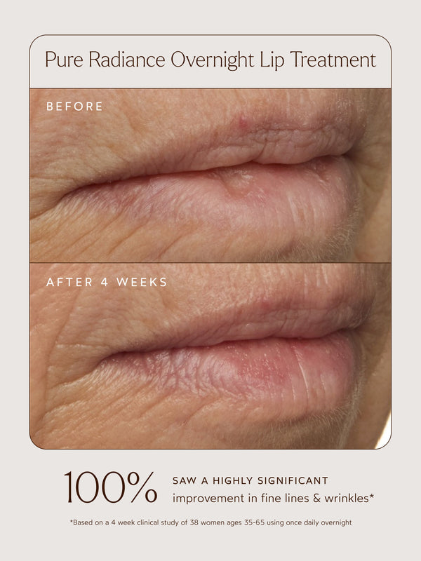 Pure Radiance Overnight Lip Treatment