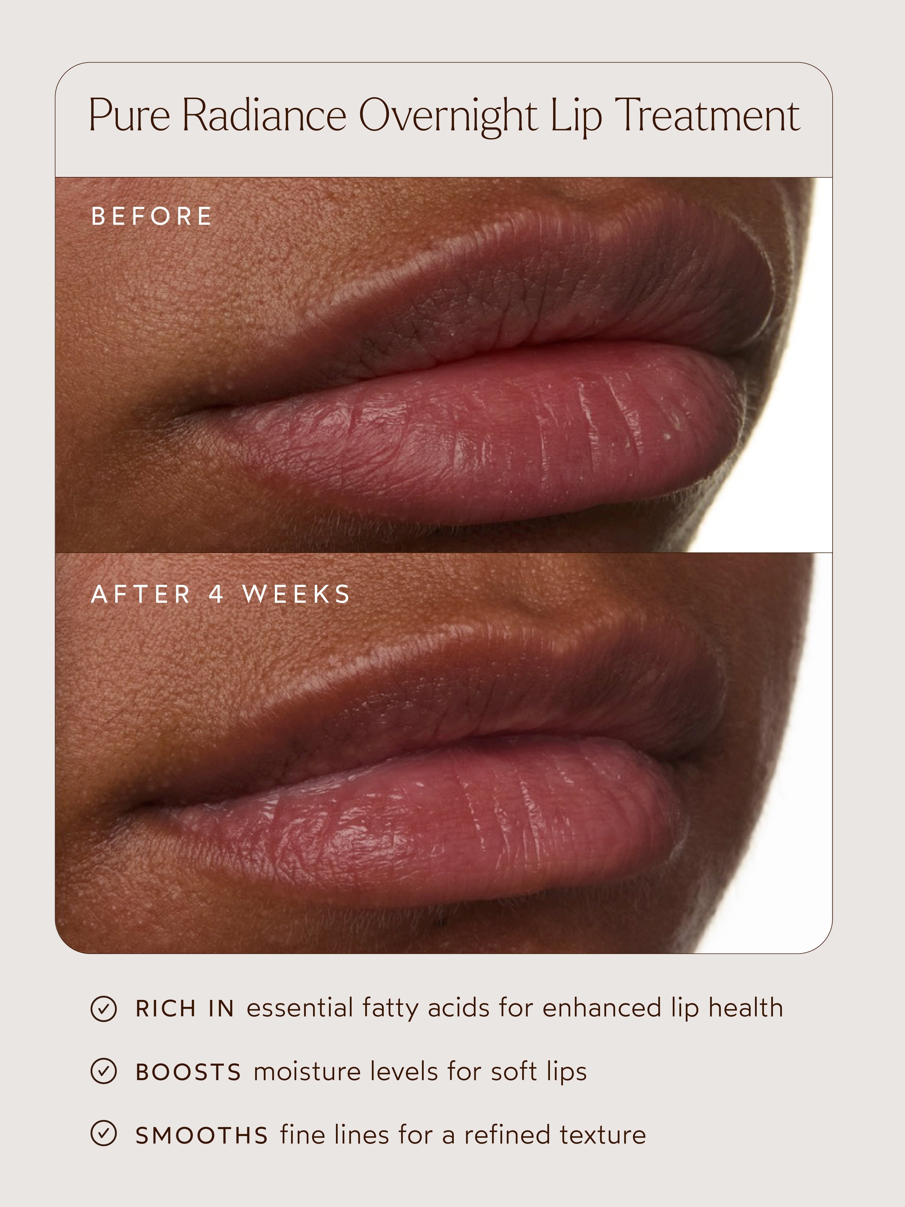 Pure Radiance Overnight Lip Treatment