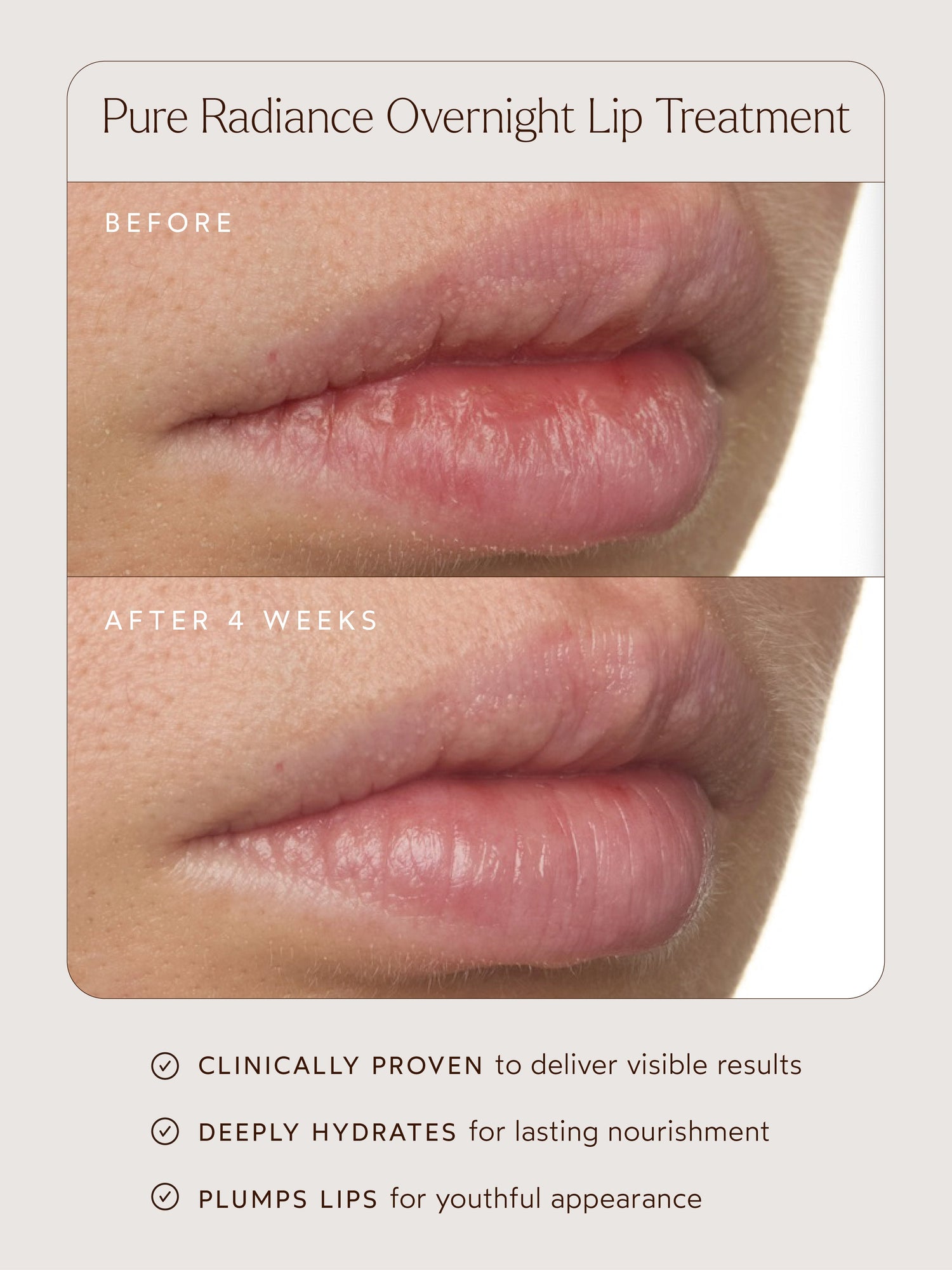 Pure Radiance Overnight Lip Treatment