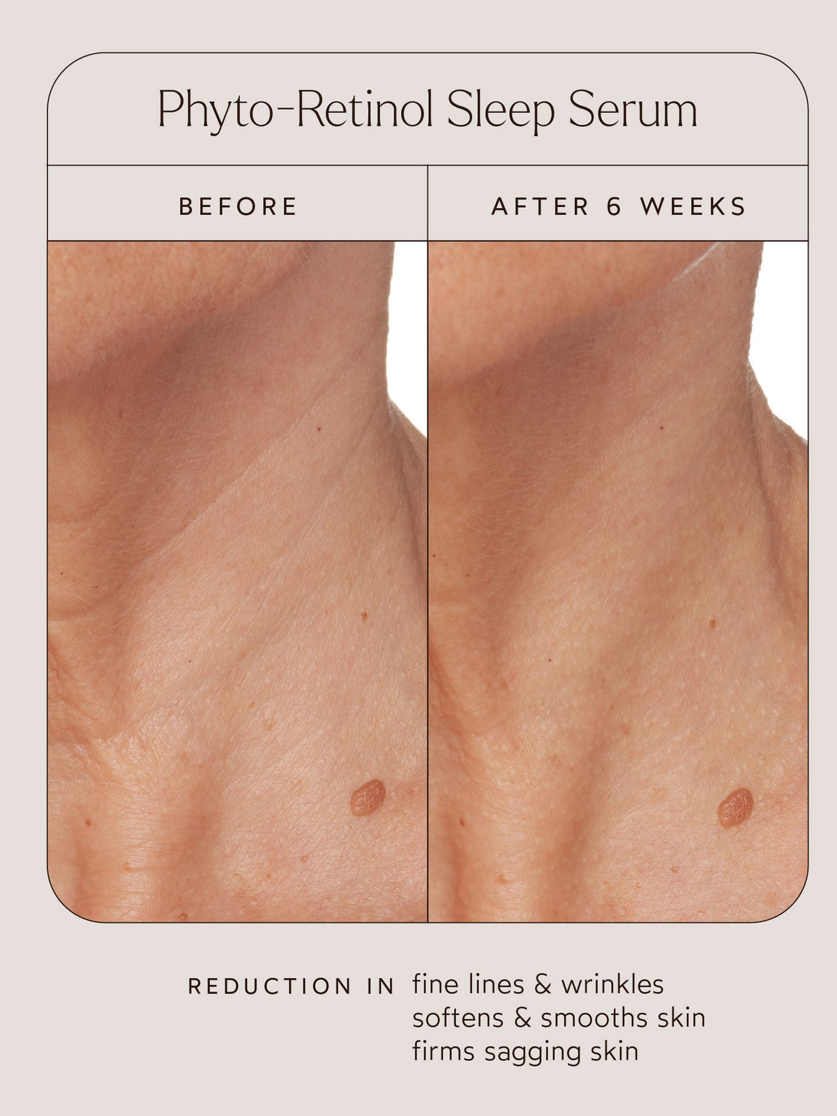 Phyto-Retinol Sleep Serum